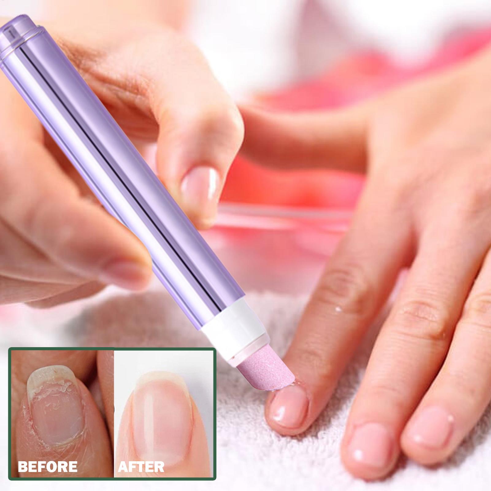 Hangnails için Seramik Ucu ile - Cuticle Oil Pen incelemesi ve fiyatı